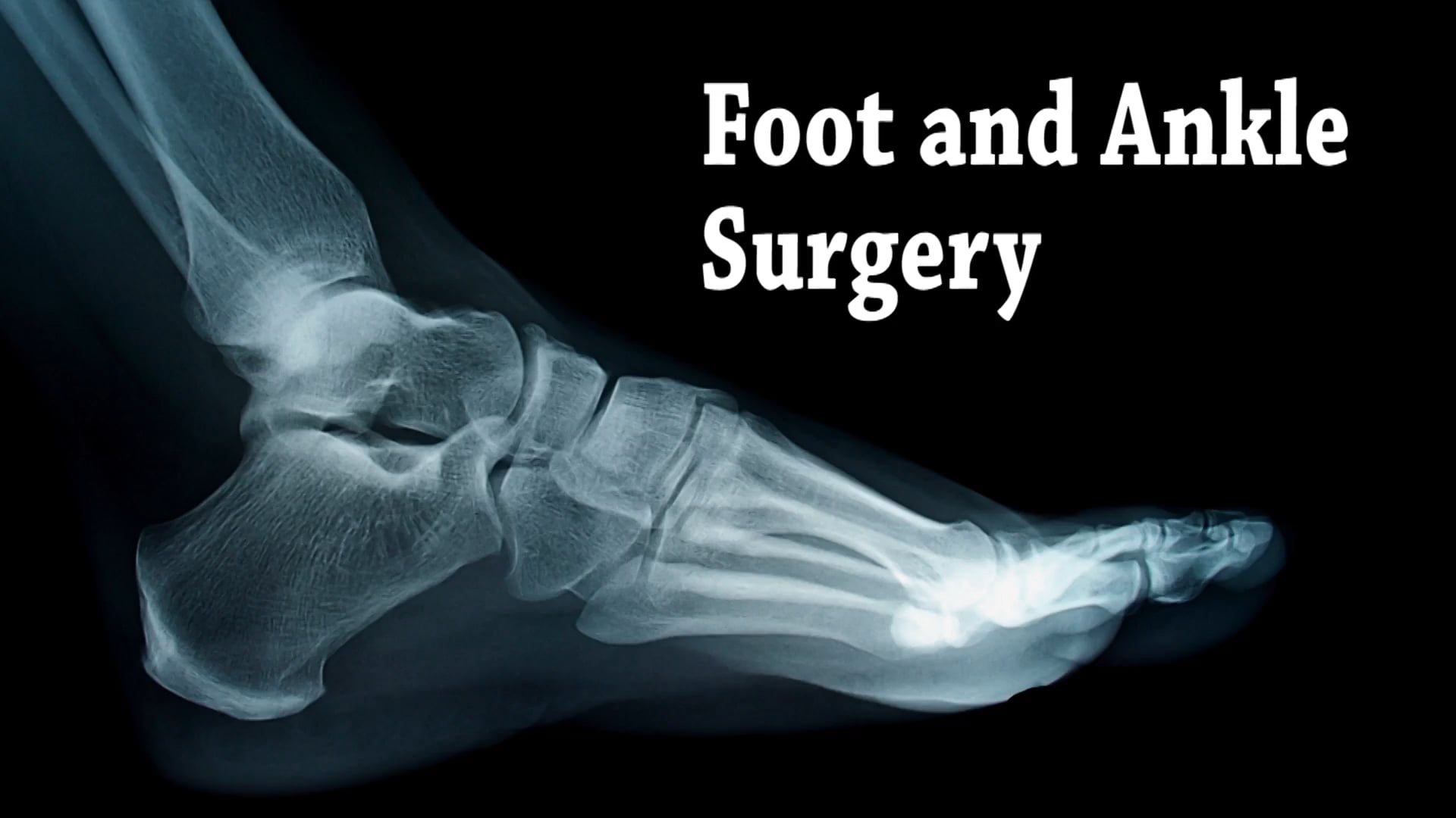 Foot & Ankle Surgery Podiatrist in Brooklyn, NY Dr. Jason Snyder