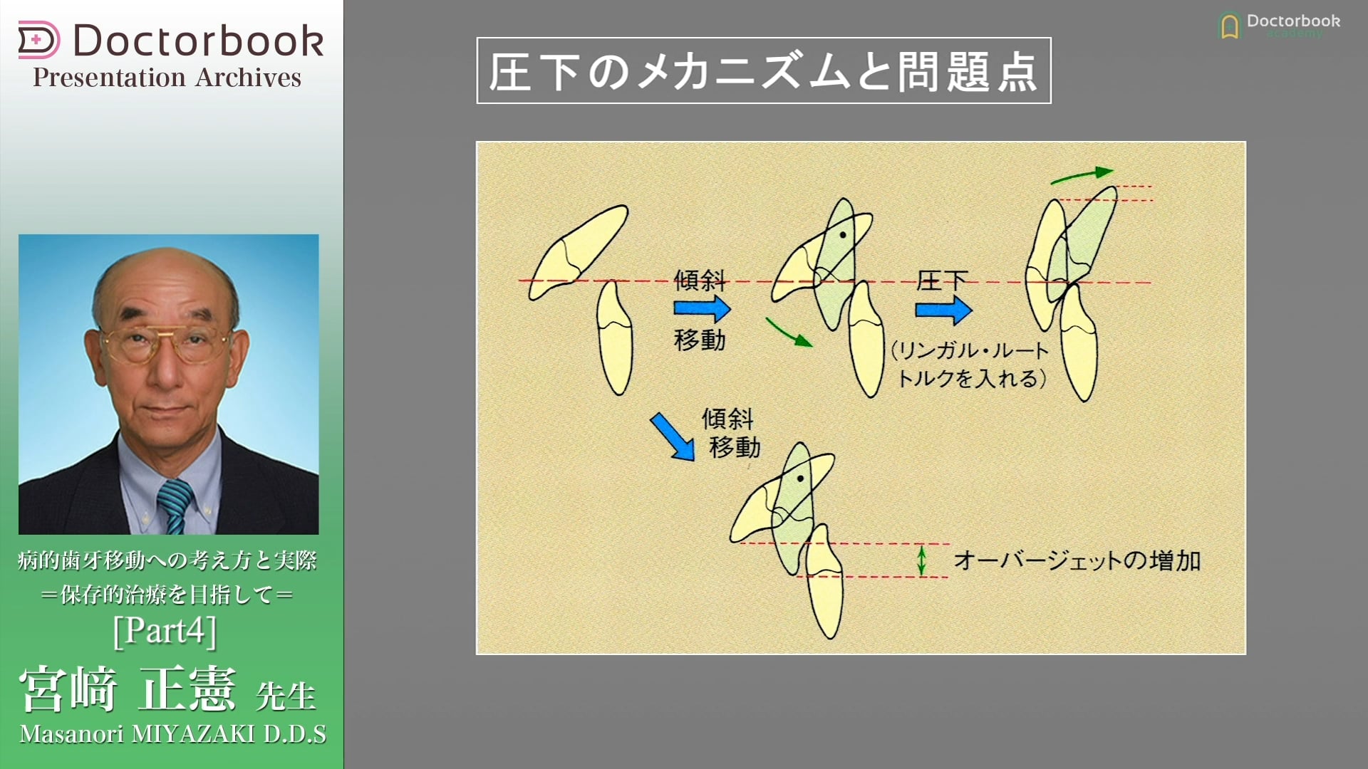 #4 圧下のメカニズムと問題点