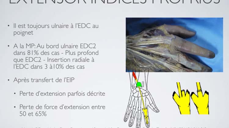 Anatomie de la main - MedG