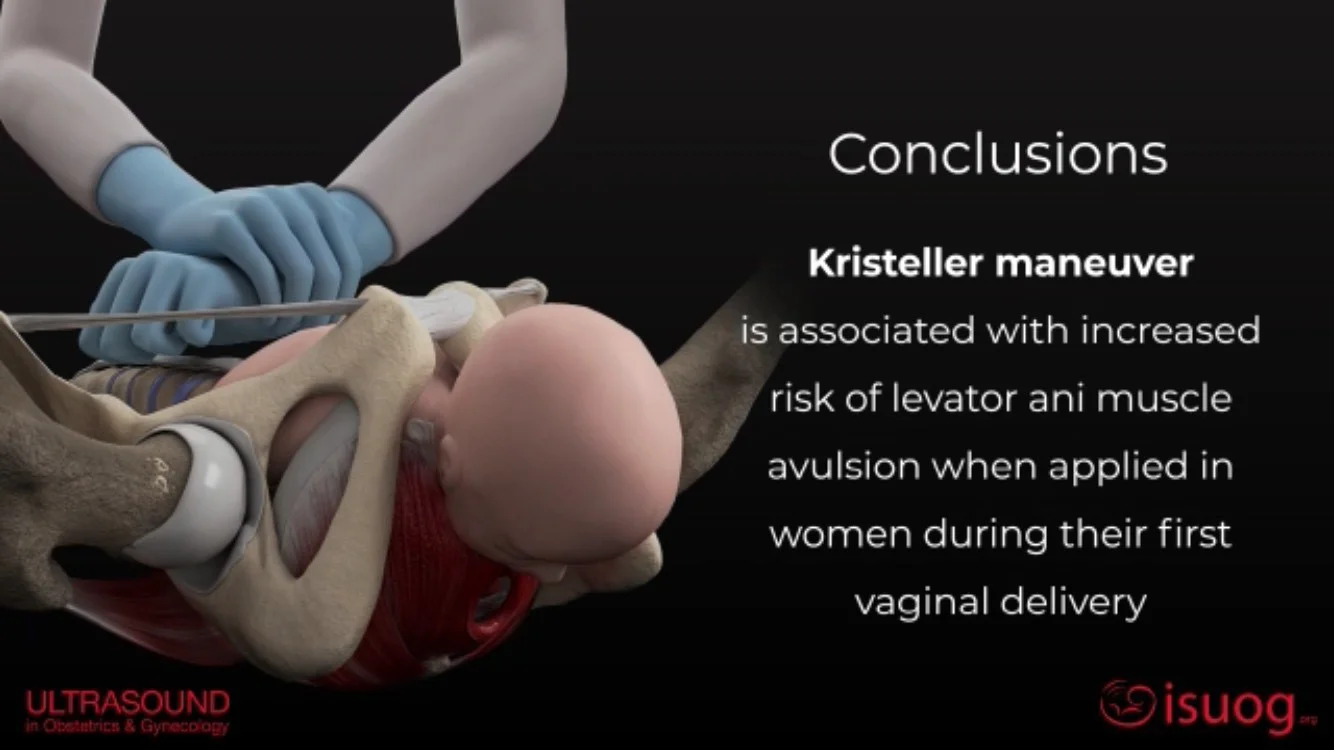 Fundal pressure in second stage of labor (Kristeller