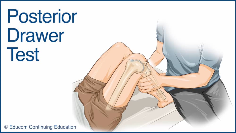 Video Posterior Drawer Test Chiropractic Online Ce Com