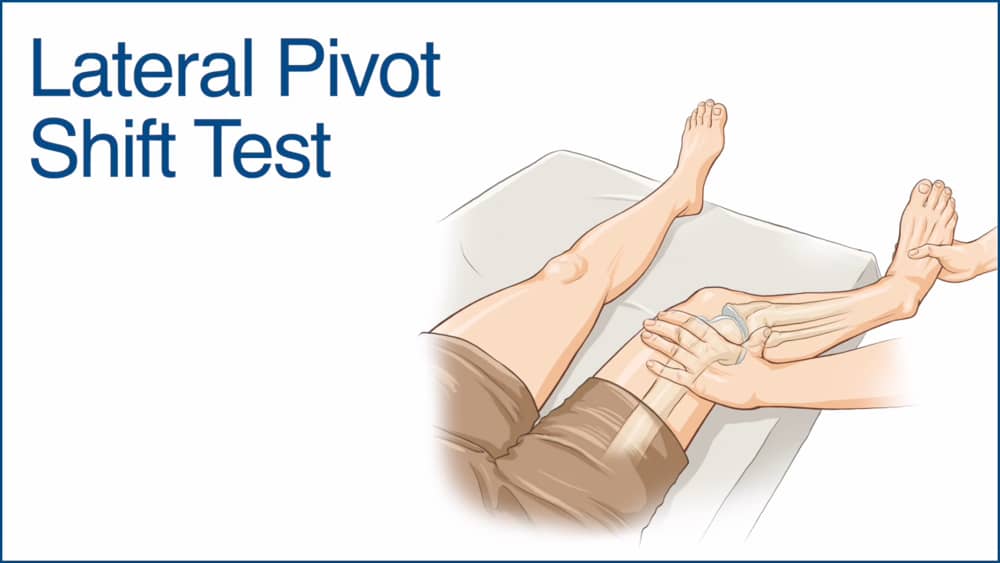 Video Lateral Pivot Shift Test Chiropractic Online Ce Com