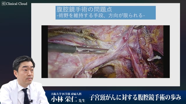 子宮頸がんに対する腹腔鏡手術の歩み