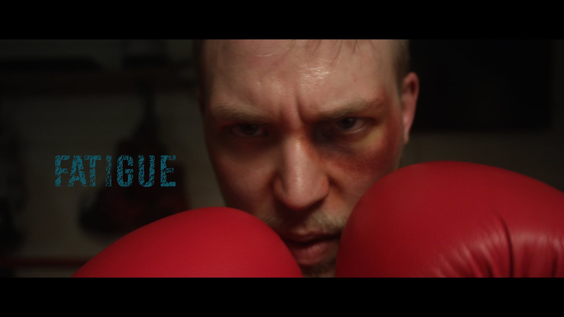FATIGUE