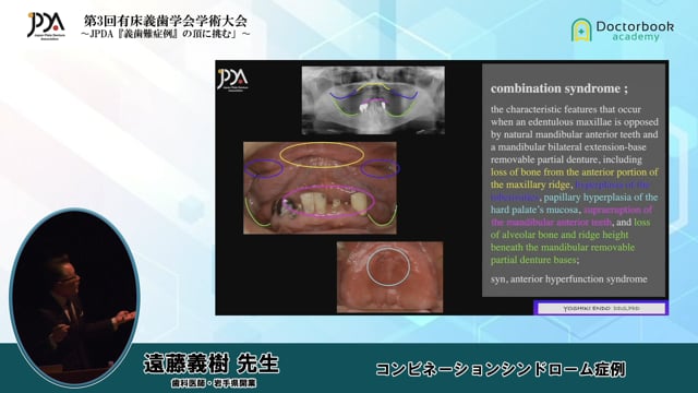 第3回 有床義歯学会学術大会