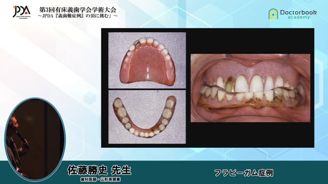 第3回 有床義歯学会学術大会