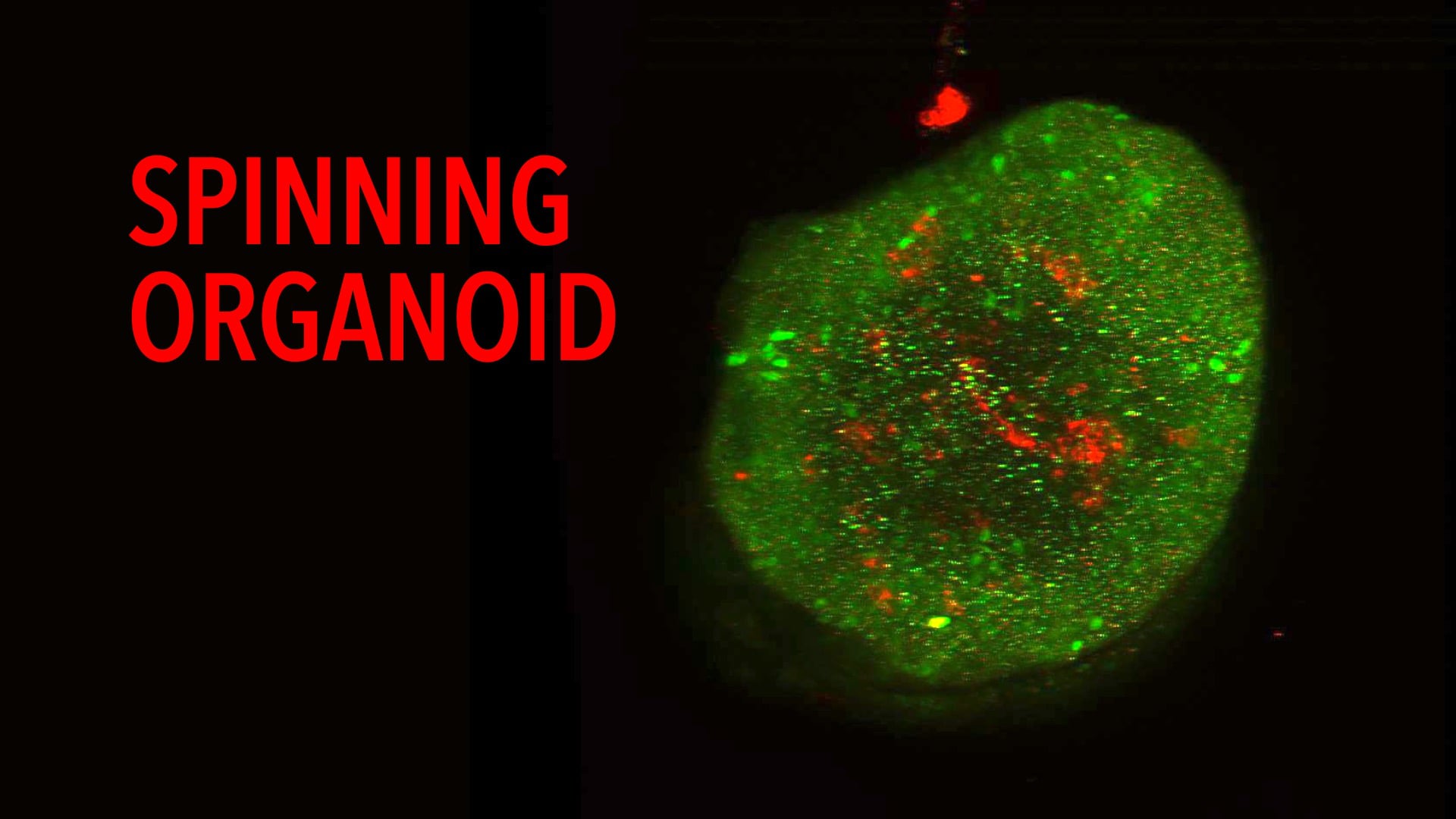 Spinning Organoid