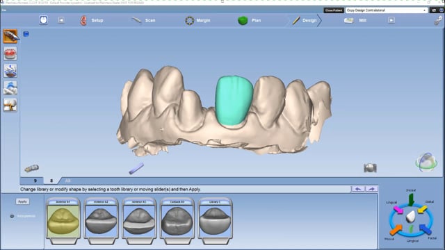 Planmeca Romexis CAD/CAM module on Vimeo