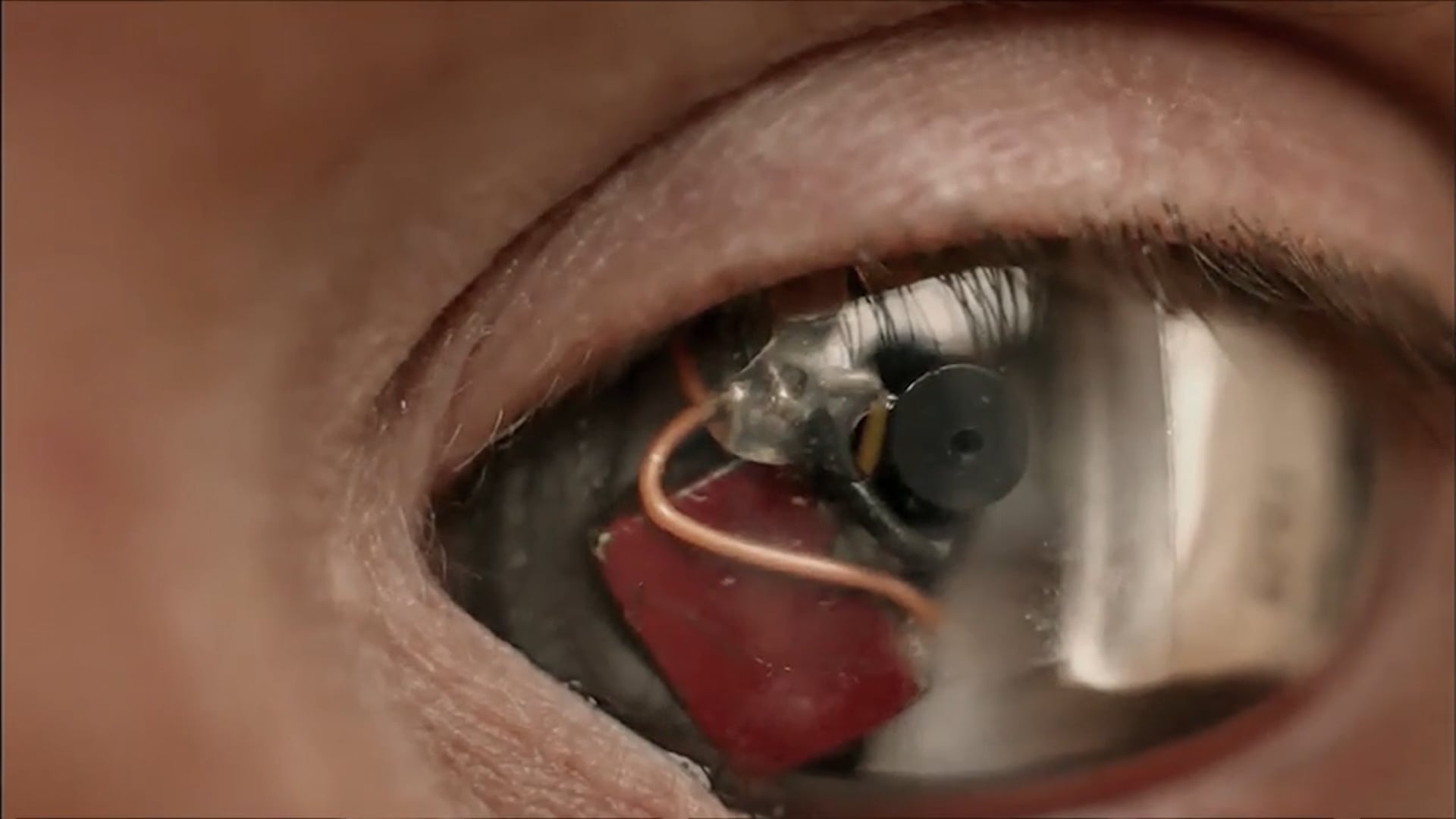 I, BIONIC