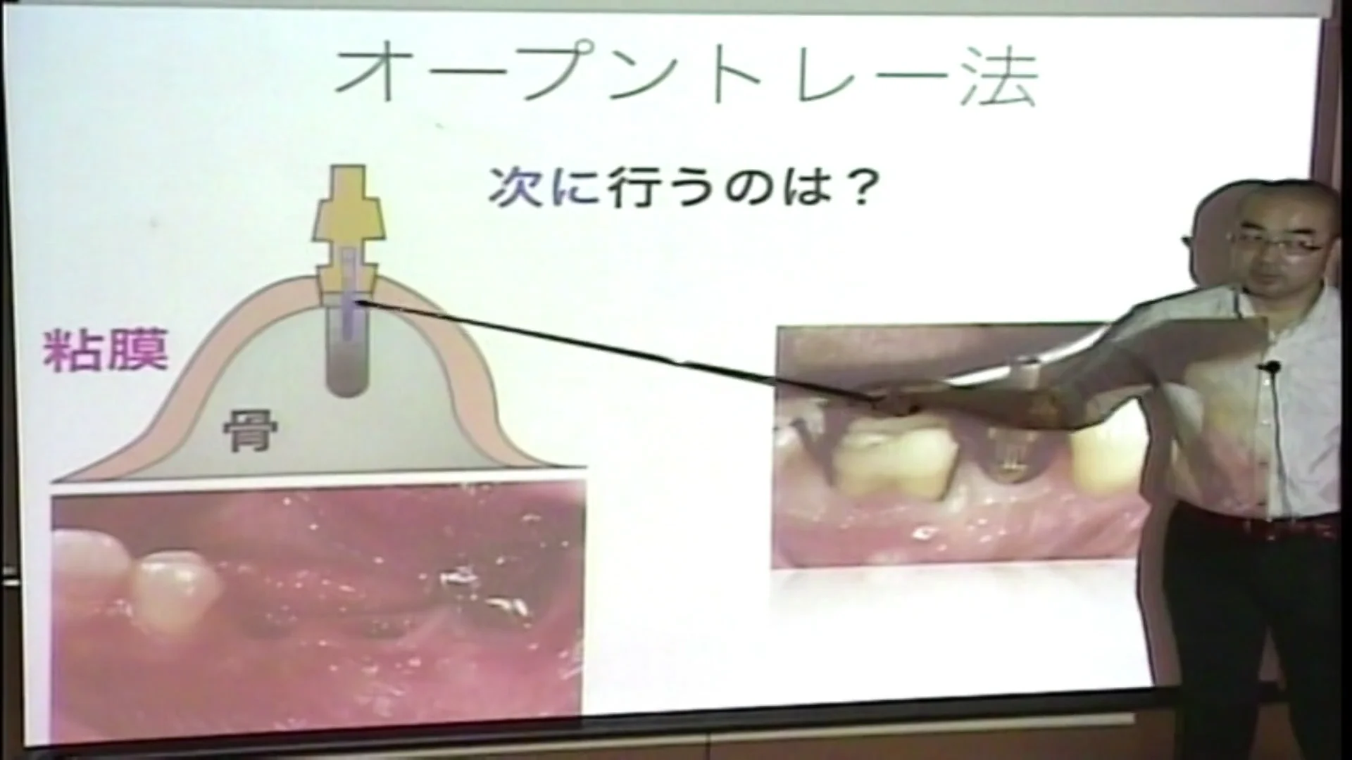 歯科医師国家試験　ドクターズセミナー講義資料 講義デモ動画紹介｜歯科医師国家試験対策予備校 Dr.'sセミナー