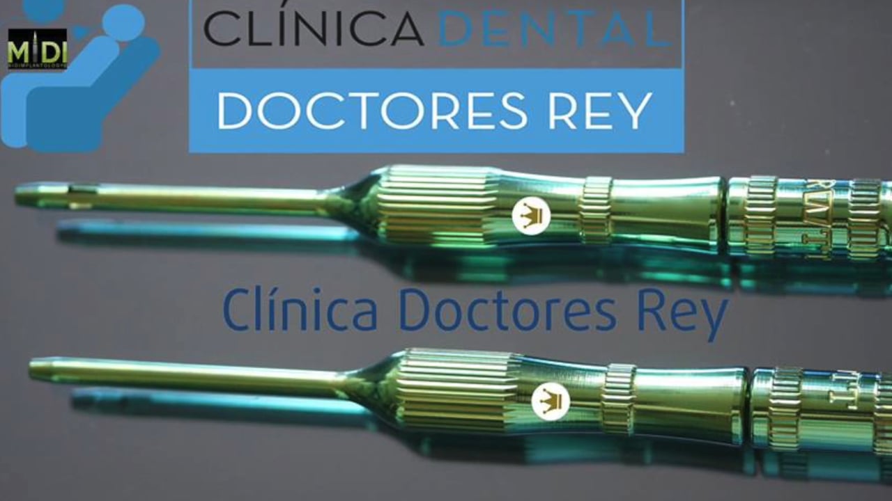 MONOIMPLANT MIDI TECHNIQUE DR REY VALLADOLID.IMPLANTES DENTALES