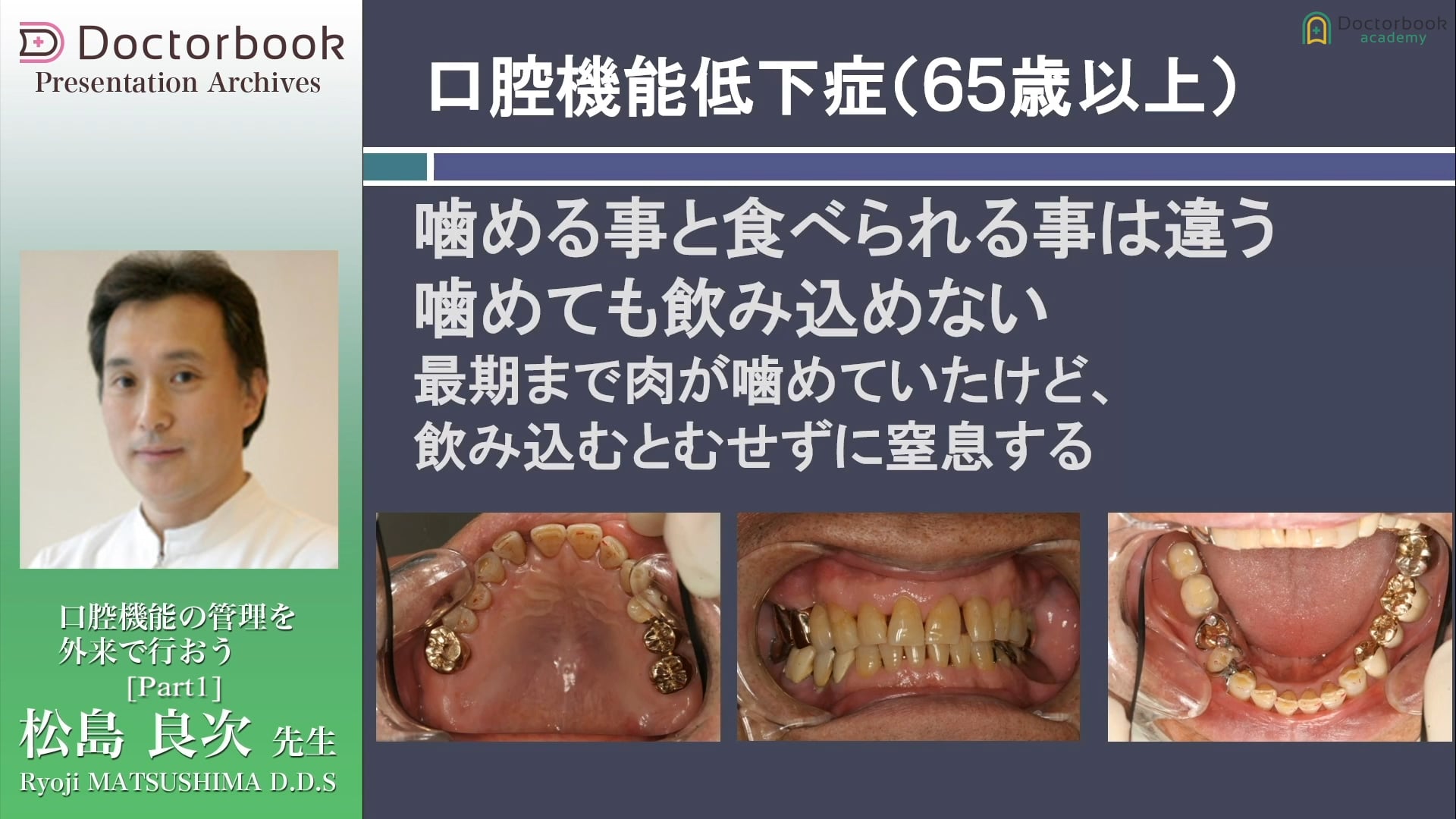 #1 口腔機能低下症とは