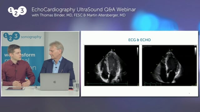 What does left bundle branch block look like in echo?