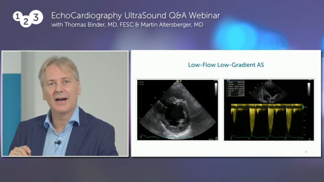 What do I have to consider when assessing AS in echo?