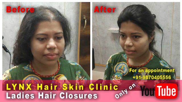 LYNX Hair Skin Clinic on Vimeo