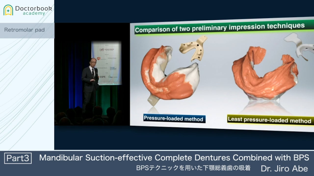 Mandibular Suction-effective Complete Dentures Combined with BPS #3