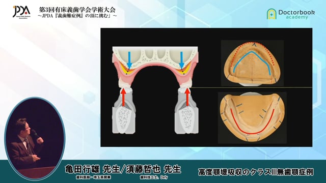 第3回 有床義歯学会学術大会