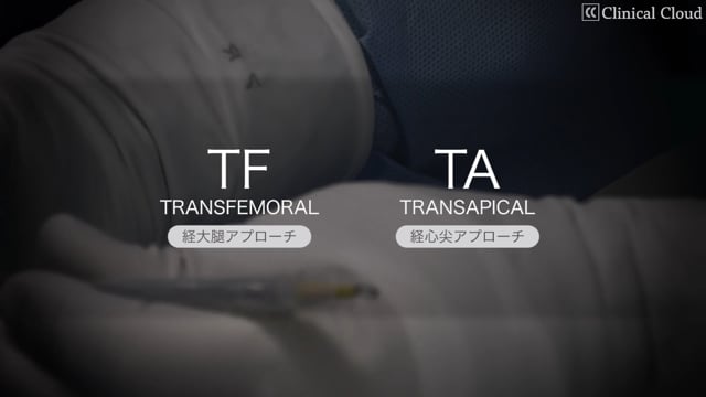 TAVI  ～CASE ; 経大腿アプローチ Part1