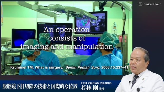 腹腔鏡下肝切除の技術と国際的な位置 Part1