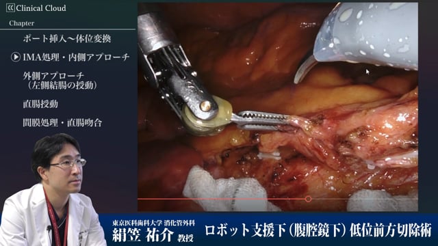 ロボット支援下低位前方切除術 Part3