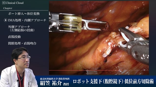 ロボット支援下低位前方切除術 Part4