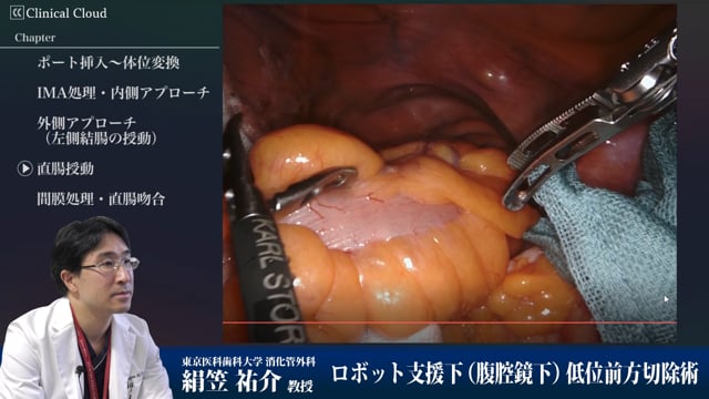 ロボット支援下低位前方切除術 Part5