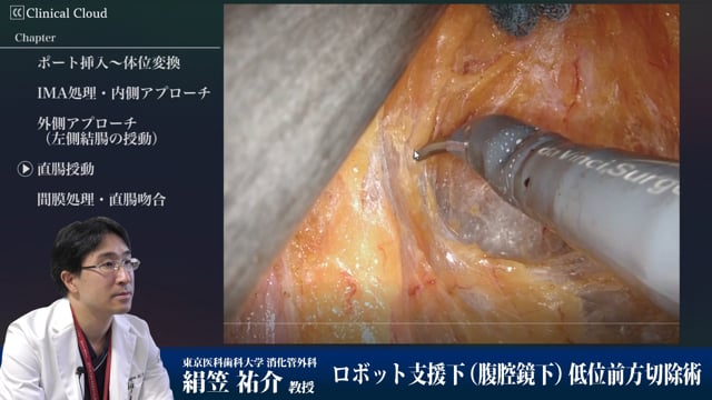 ロボット支援下低位前方切除術 Part6