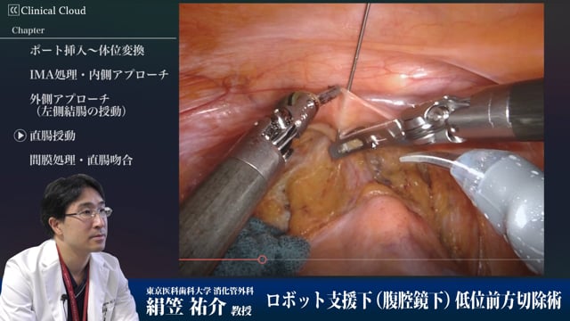 ロボット支援下低位前方切除術 Part7