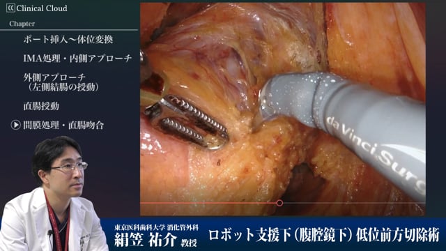 ロボット支援下低位前方切除術 part8