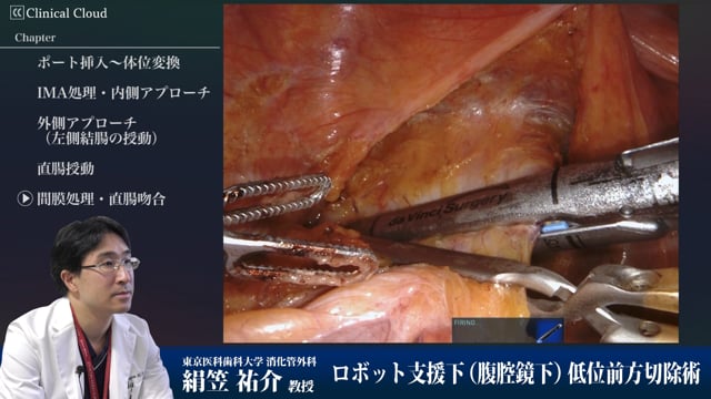 ロボット支援下低位前方切除術 Part9