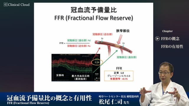 冠血流予備量比の概念と有用性