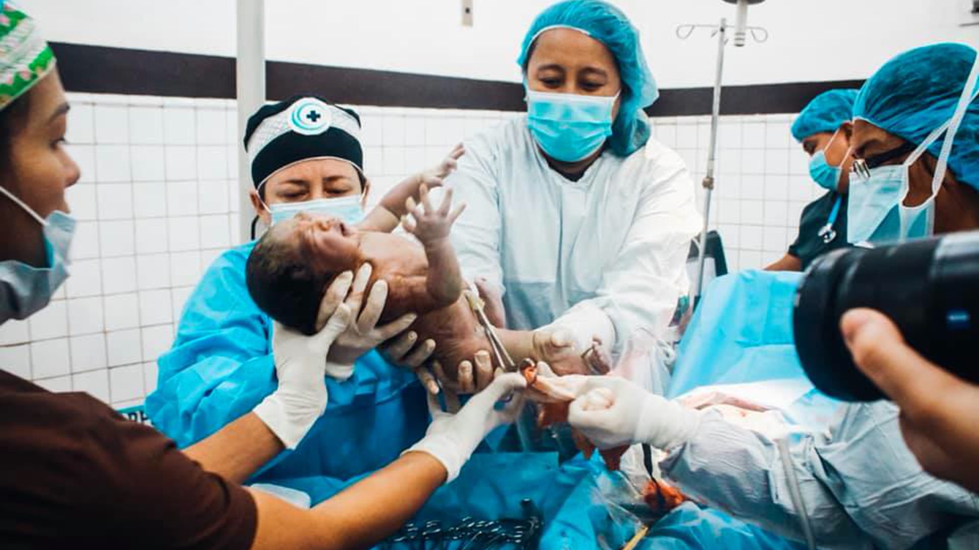 MMI Philippines - C Section