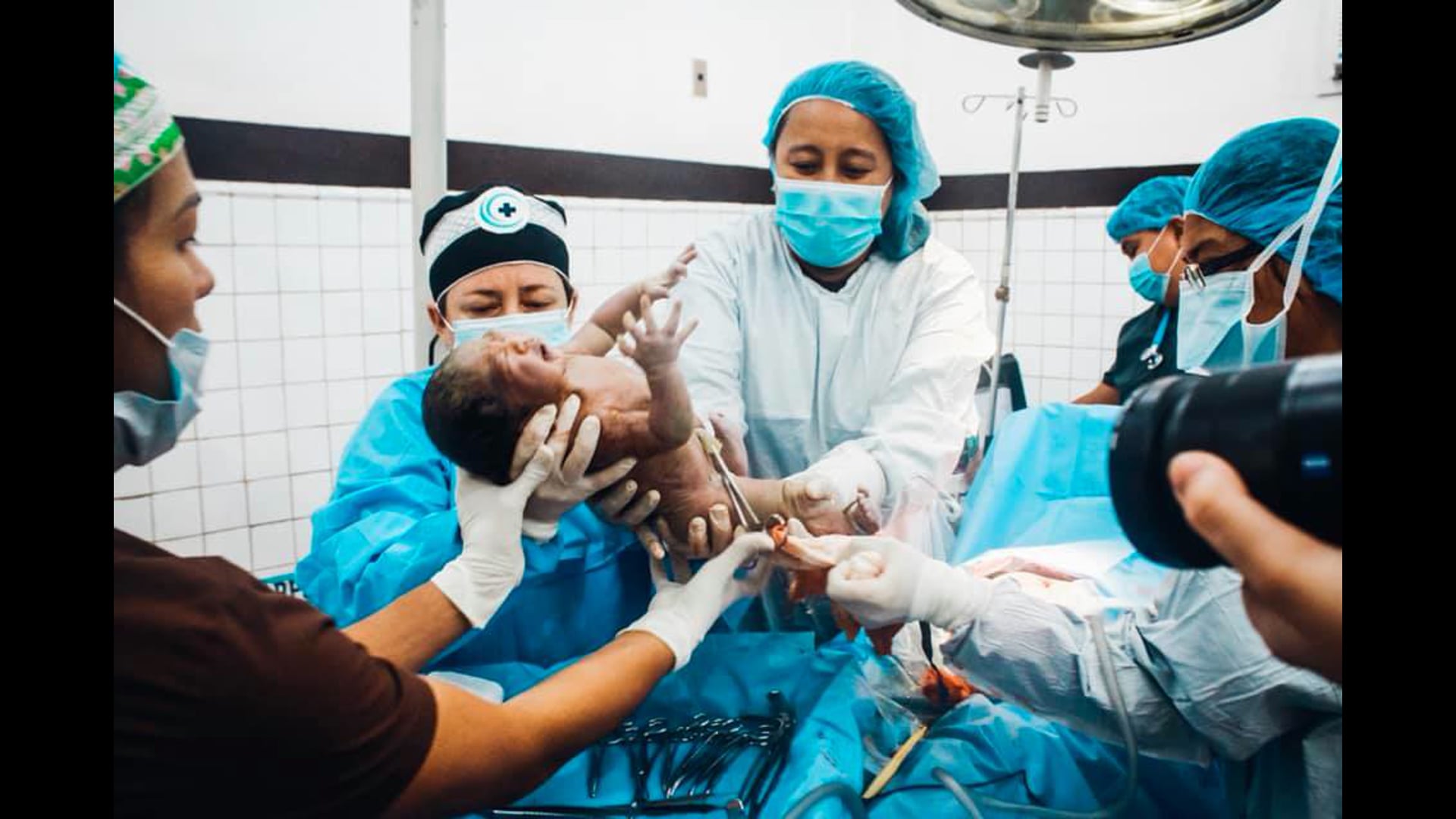 MMI Philippines - C Section