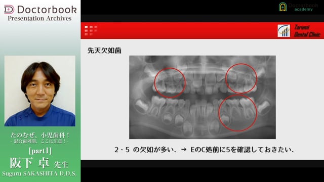 たのむぜ、小児歯科！〜混合歯列期、ここに注意！〜