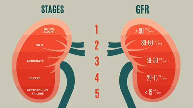 stage 1 kidney failure