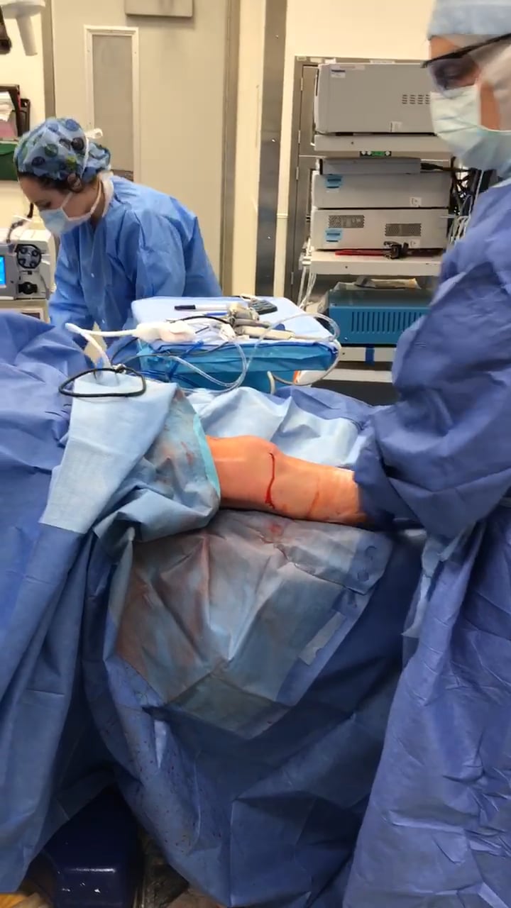 Knee MUA (as part of an arthroscopy) on Vimeo