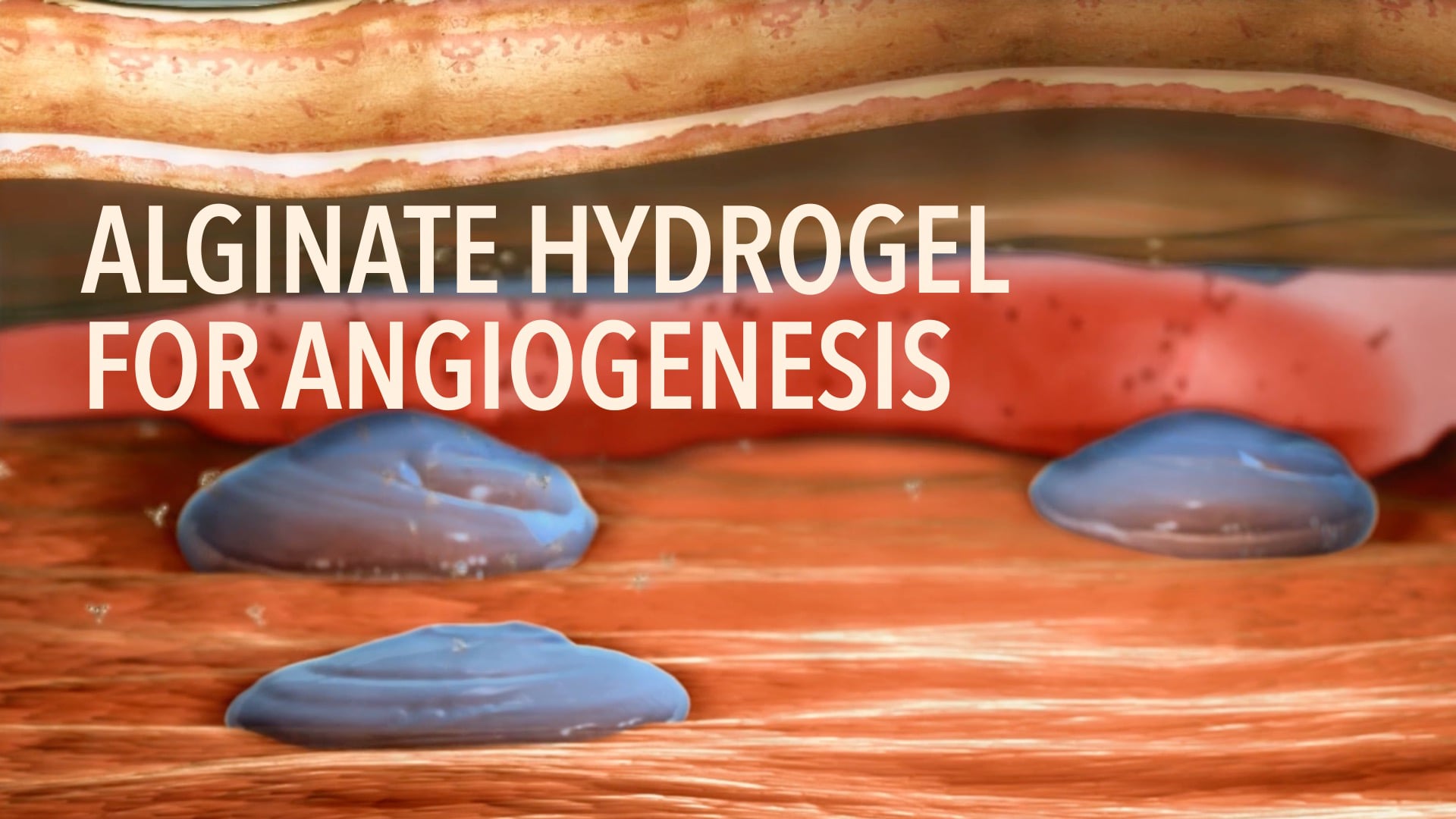 Alginate Hydrogel for Angiogenesis