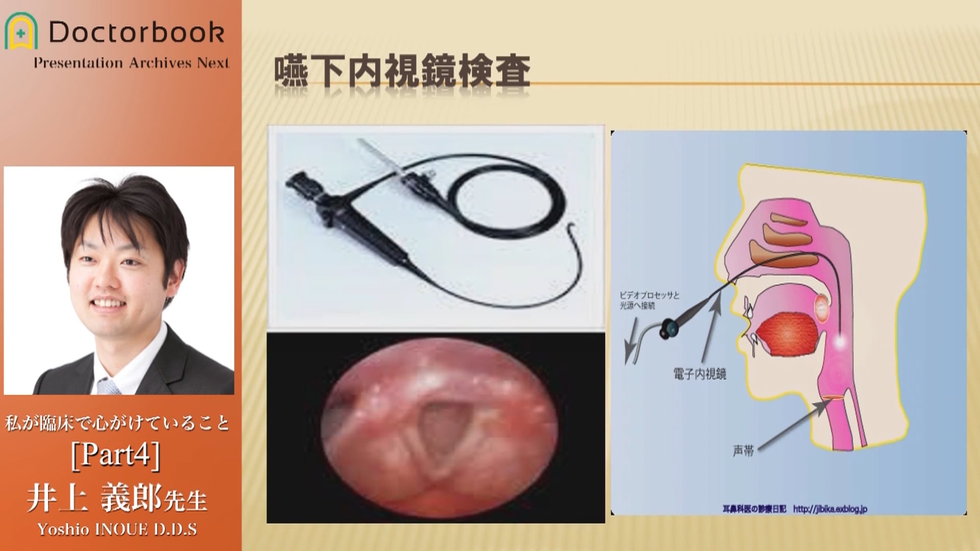 #4 口腔機能低下症