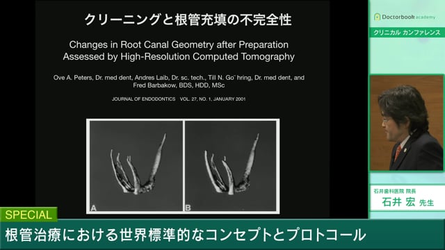 根管治療における世界標準的なコンセプトとプロトコール | Doctorbook 