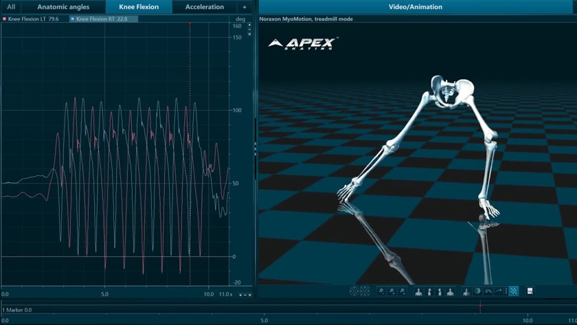 vimeo-video-thumbnail