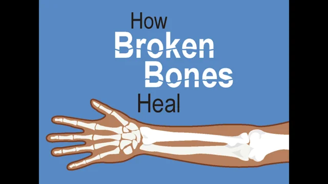 broken bones out of skin real