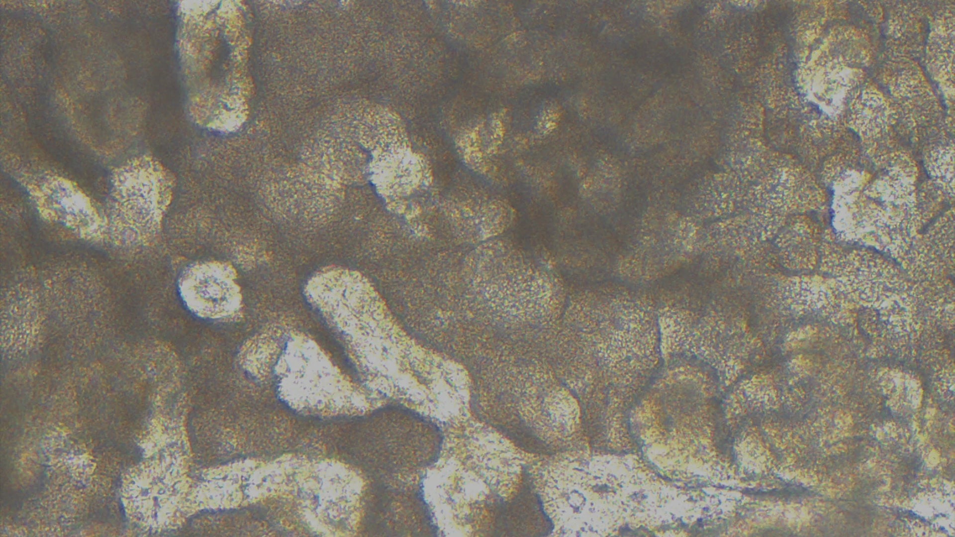 Duodenum Chip (260) with 36wk CGA microbiome at 72h high res widescreen