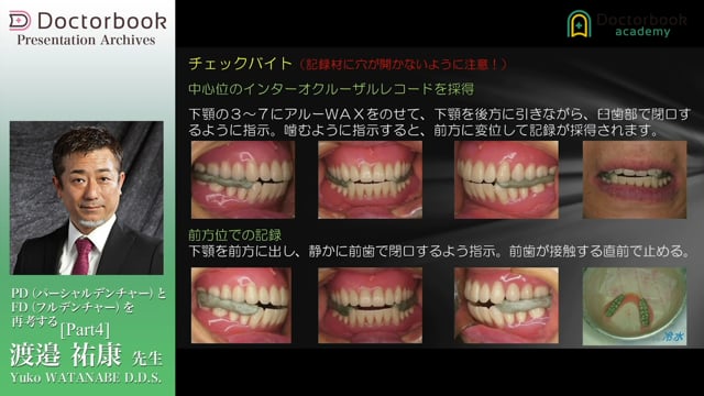 パーシャルデンチャーアドバンスプログラム | Doctorbook academy (ドクターブックアカデミー)