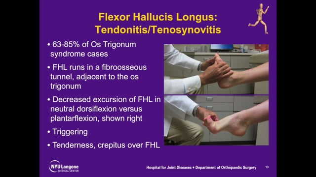 Os Trigonum Excision in Dancers via an Open Posteromedial Approach