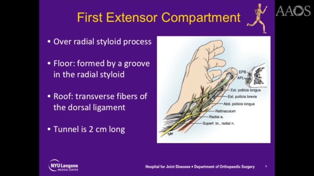 First Extensor Compartment Release For De Quervain's Tenosynovitis ...