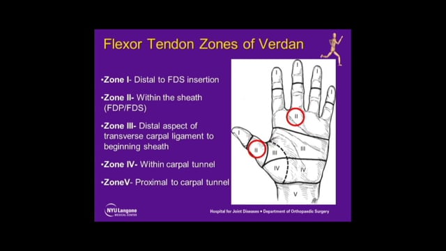 Zone 2 Flexor Tendon Injuries: Primary Repair & Secondary Reconstruction