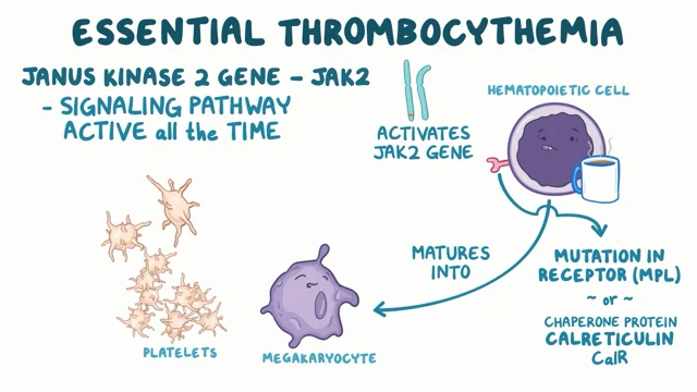 Essential Thrombocythemia - Symptoms, Causes, Treatment