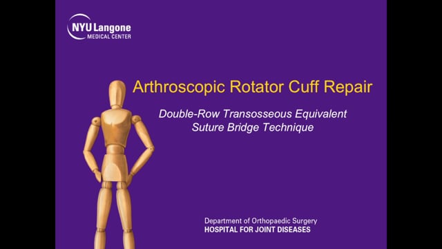 Arthroscopic Rotator Cuff Repair using a Double Row Transosseous Equivalent Suture Bridge Technique
