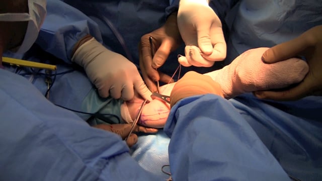 Distal Biceps Repair