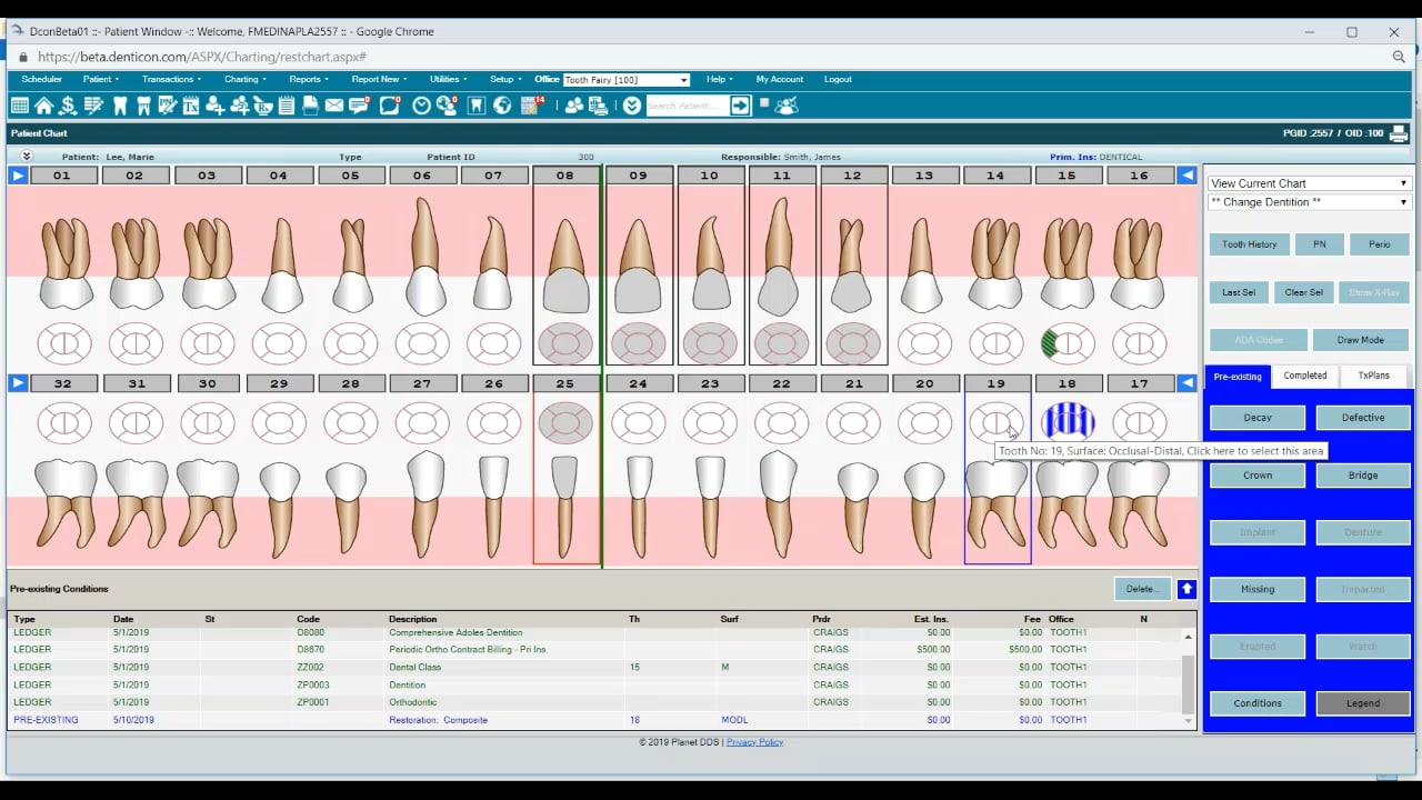 Getting Started with Denticon's Restorative Chart and Treatment ...